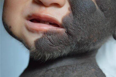 孕妈二胎早产生下"狼孩",看到孩子,老公大喊:快扔掉