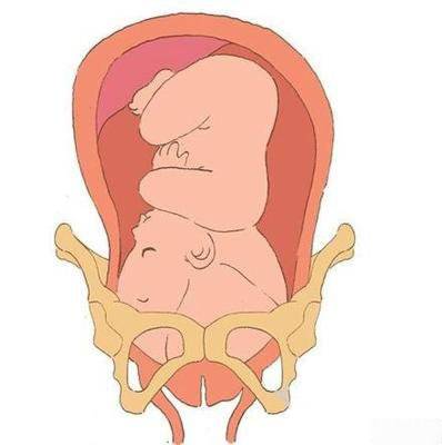 耻骨疼得早是不是生的比较快?有这三个特征的孕妇生孩子会比较快