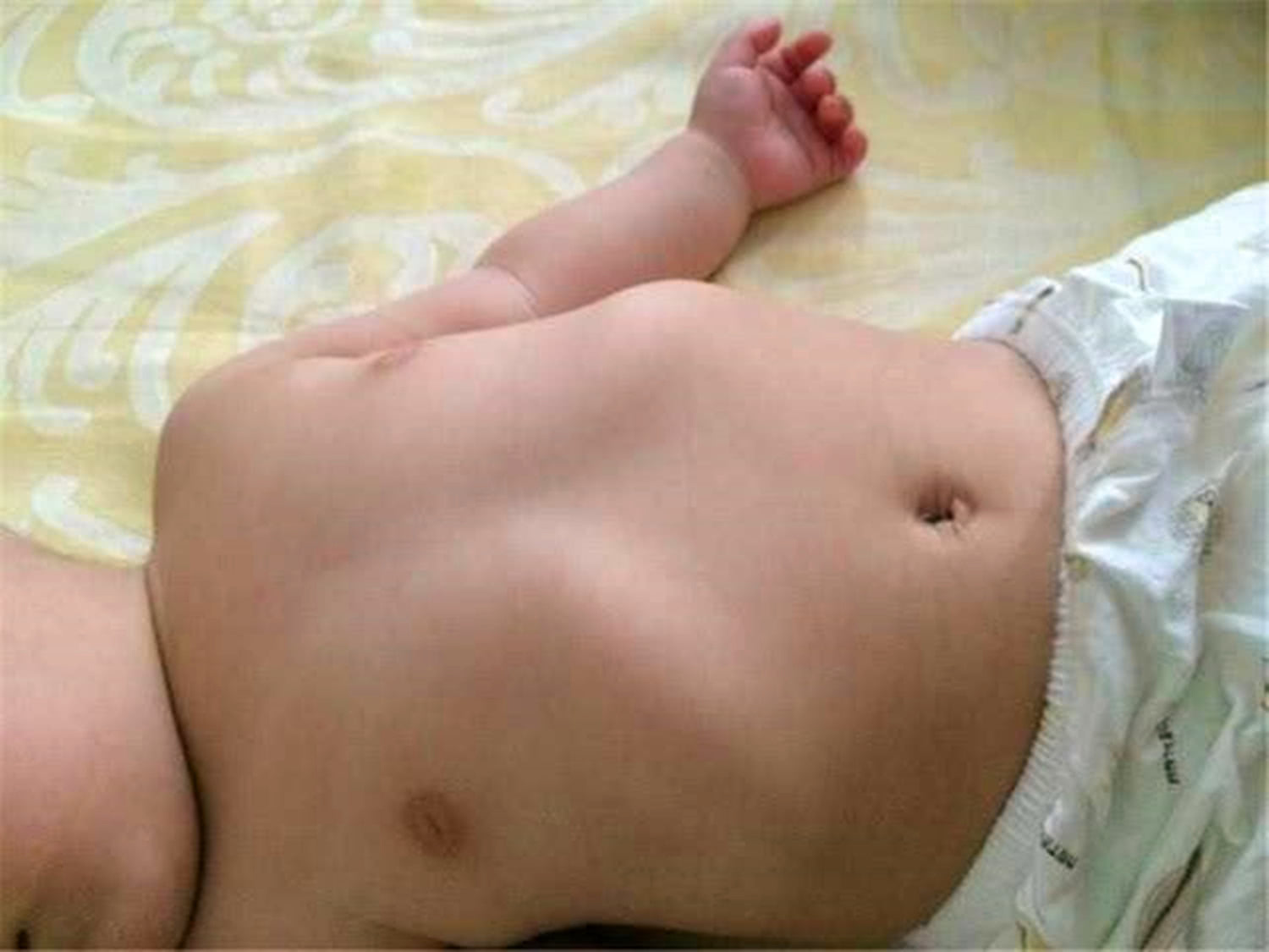 鸡胸会遗传吗 baijiahao.baidu.com