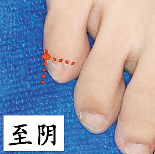 孕产妇胎位不正可试试艾灸这个穴位