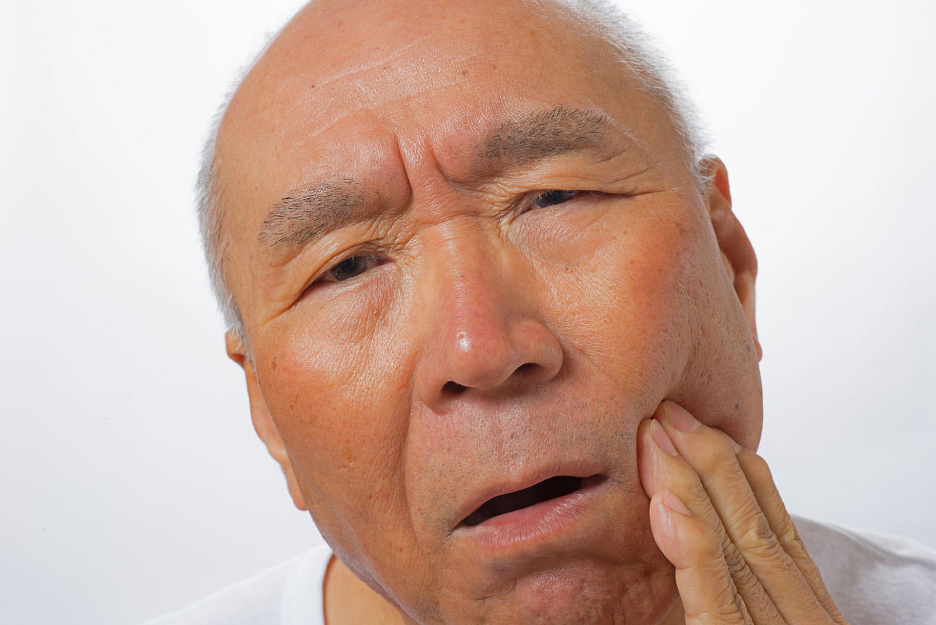 面瘫是中风的一个常见并发症,主要是由于脑部血液供应中断或脑神经