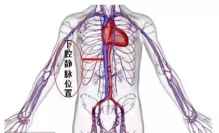 肿瘤从盆腔爬到心脏,医生说没救了!她是怎么死里逃生的?