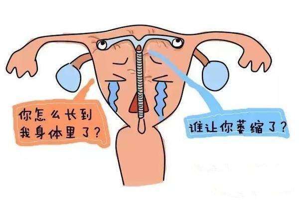 为什么不建议女人上环图片