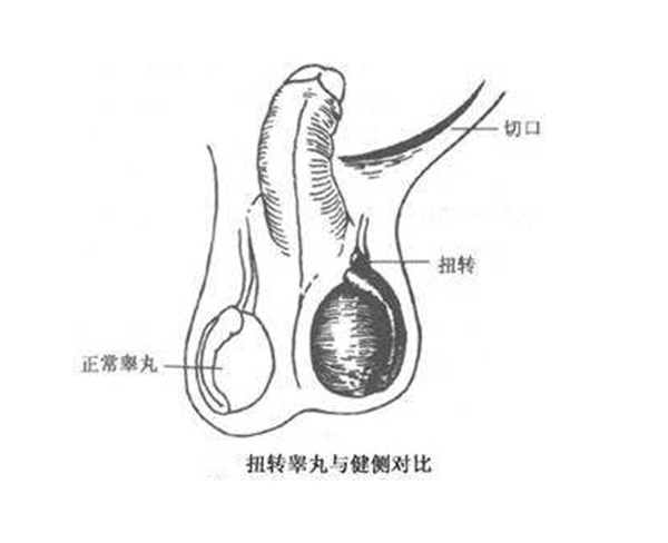 12岁男睾丸图片