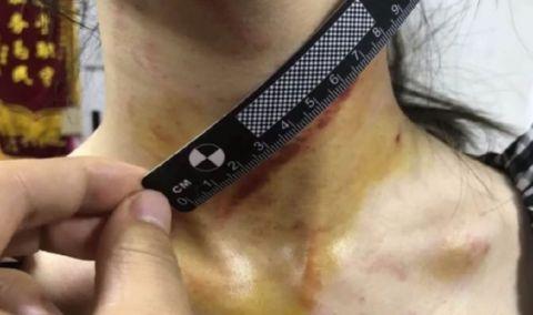 劫匪持刀尾随 30厘米长的剪刀架在脖子上,这对姐妹应对太机智