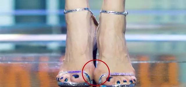 女星的脚真吓人,宋茜畸形,冉莹颖全是伤痕,而郭碧婷十分痛苦