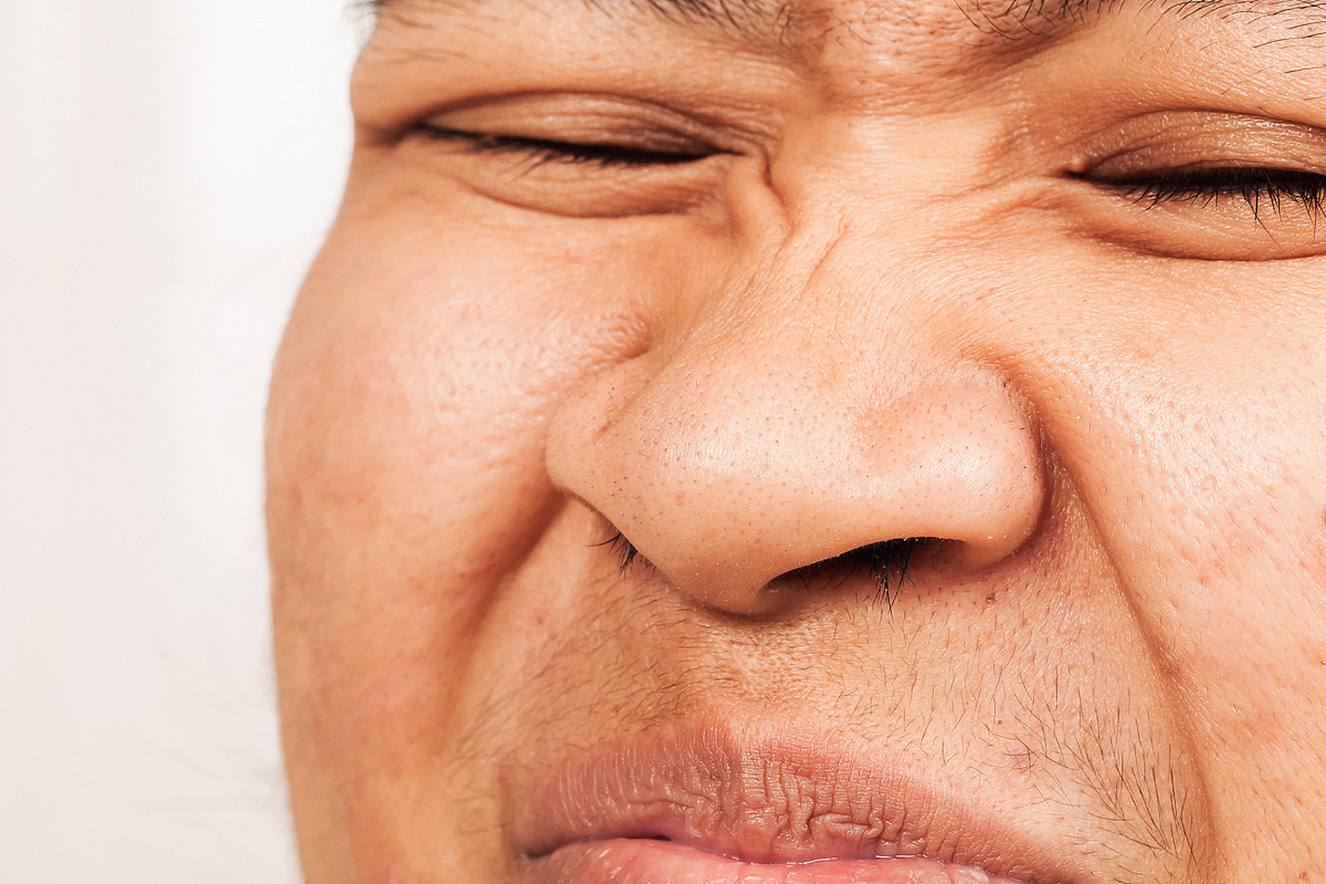 面瘫的早期症状有哪些 面瘫,也被称为面肌麻痹,是一种面部肌肉功能