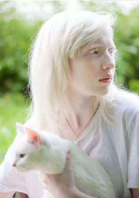 这个18岁的女孩子被称为"仙女",眼睛是紫瞳,头发和皮肤很雪白