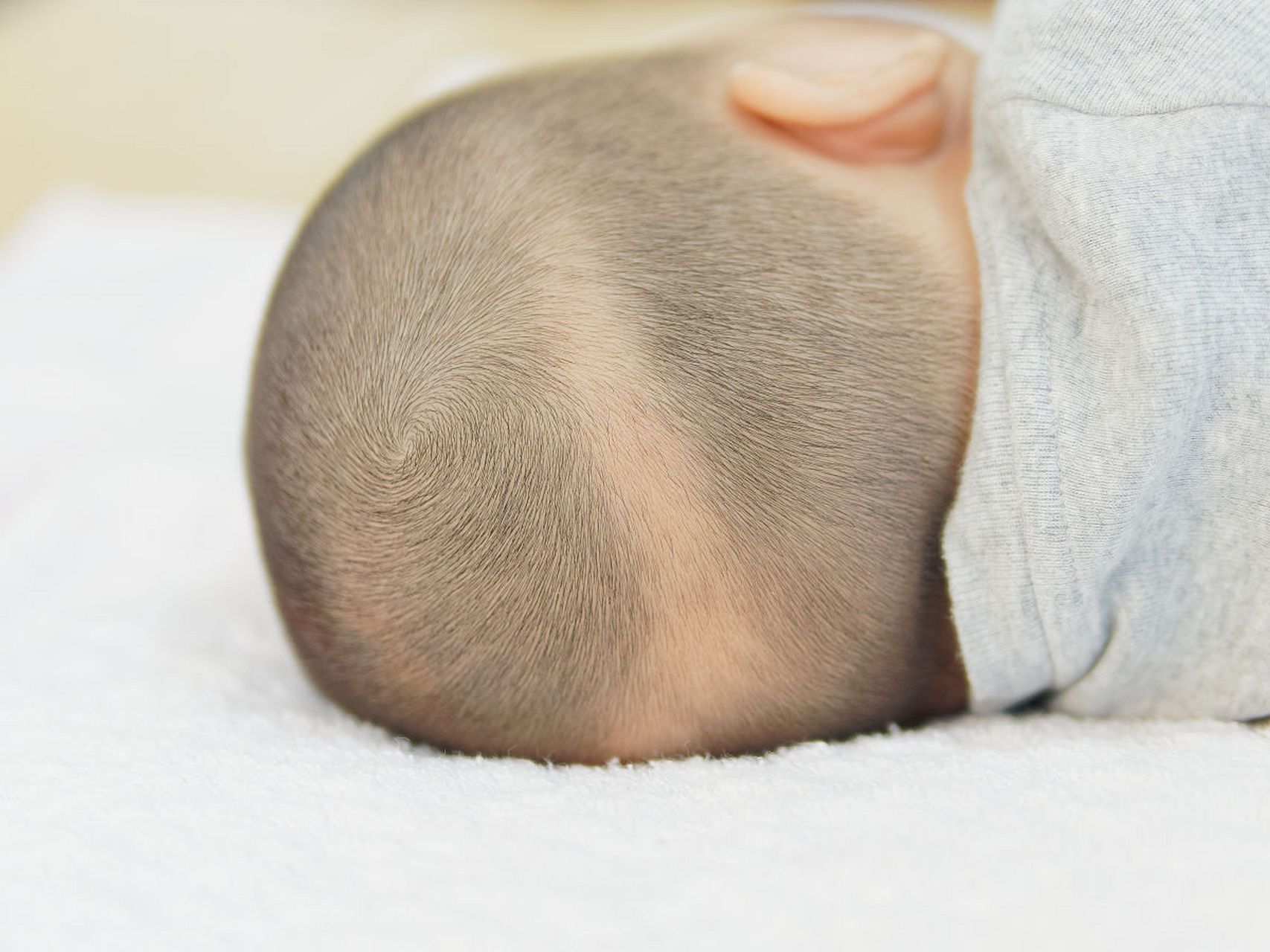 宝宝头皮上的黄色结痂,可能是一种叫做乳痂的皮肤病.