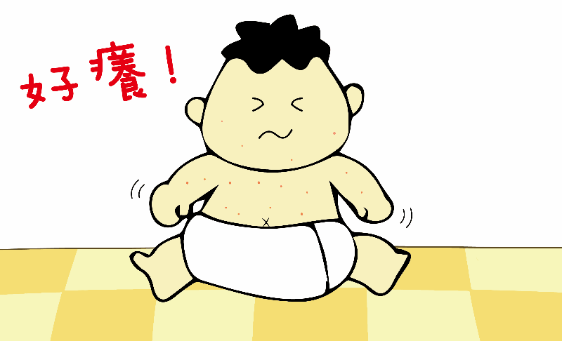 怎样处理痱子和湿疹?