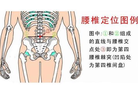 十几年的腰间盘突出导致的腿疼,如果继续发展会有什么后果?