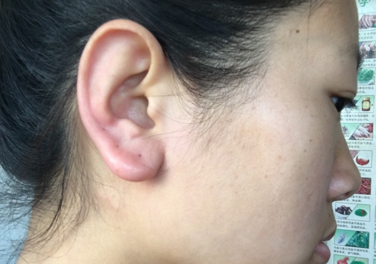 右耳发烫 baijiahao.baidu.com