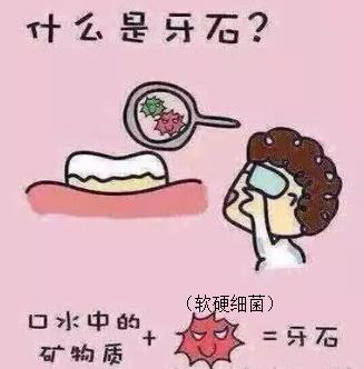 牙齿也会长结石?专业牙医告诉你牙结石的前世今生!
