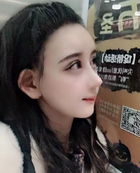 女子整容太疯狂,人中鼻孔全整没了,网友:看起来像个假娃娃