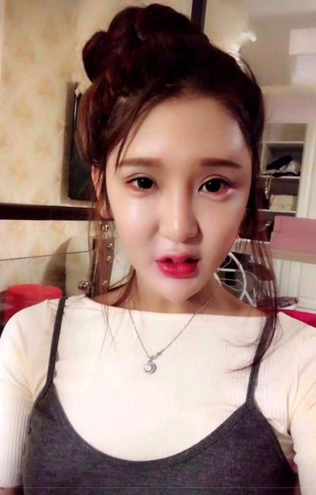 一张脸价值85万,"蛇精脸"靠整容意外走红,网友:学徒整的?