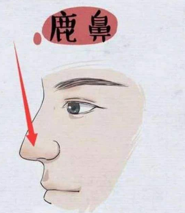 鹿鼻面相的名人图片