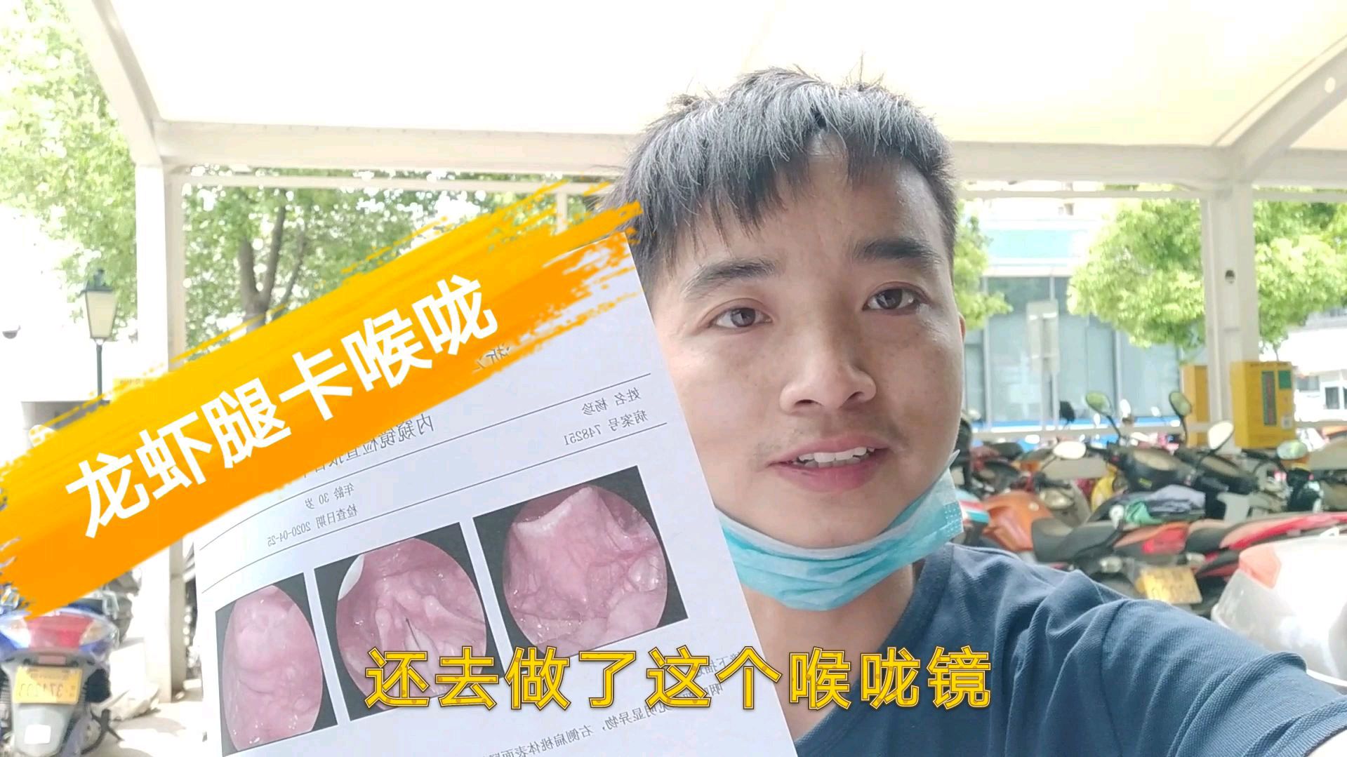 现在是吃小龙虾的季节,浙江一小伙被龙虾腿卡喉咙,然后