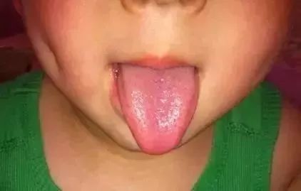 九个月宝宝的舌头图片图片