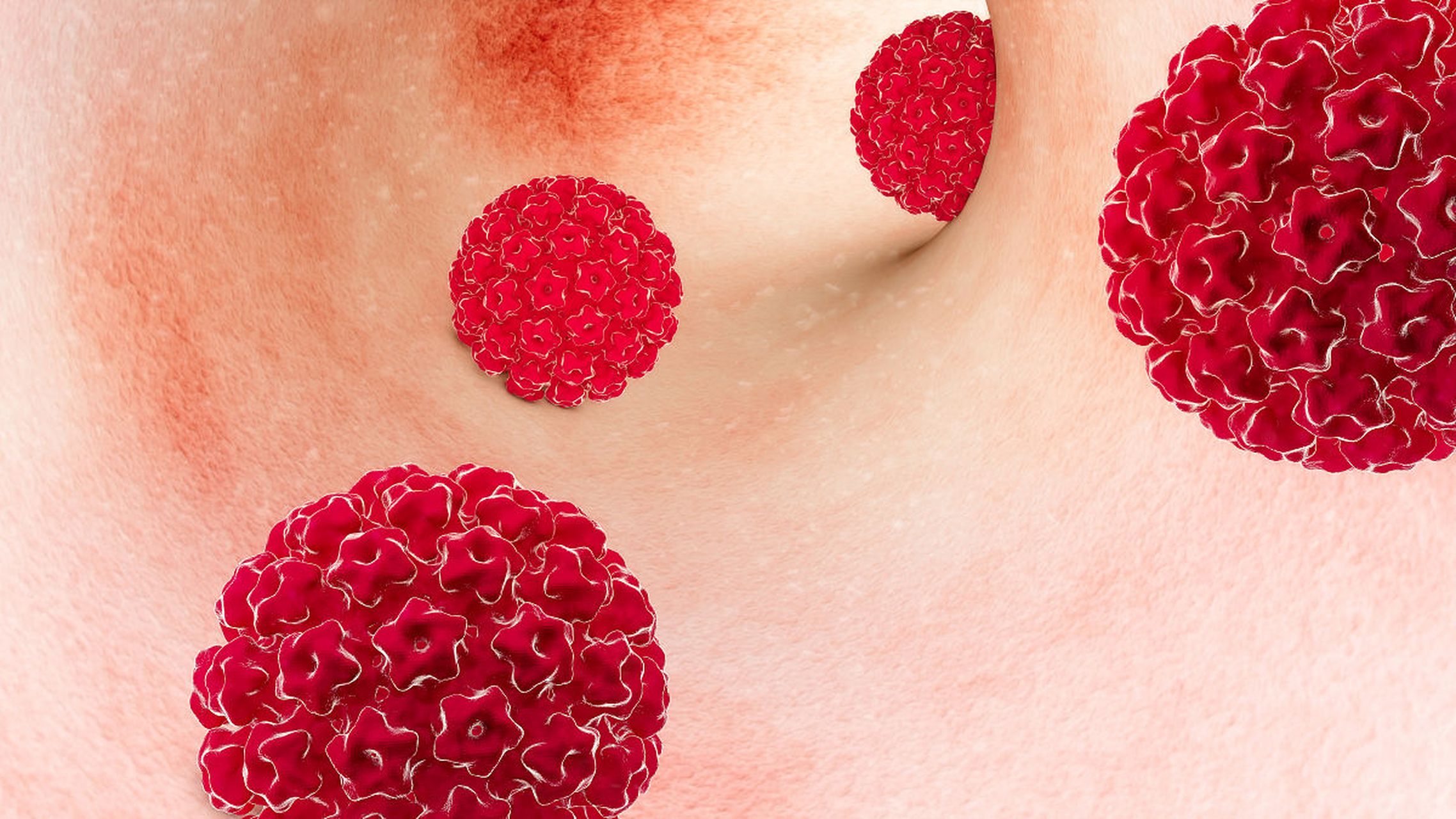 hpv最全科普8715这9件事情一定要知道  人乳头瘤病毒(hpv)是一种