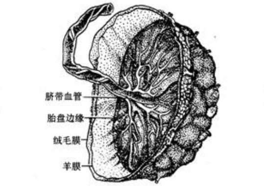 膜状胎盘图片 示意图图片