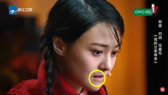 明星脸上疤痕:郑爽嘴角被烫伤,俞灏明毁容,孙俪因祸得福成标志