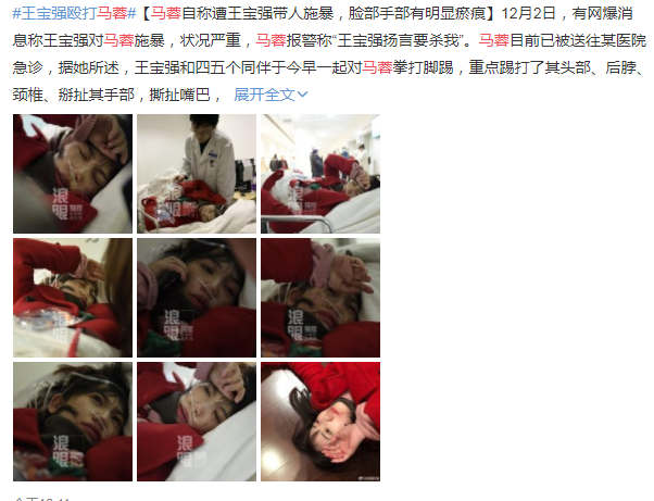 专业律师分析马蓉"家暴"事件:如果是王宝强打的,那他前功尽弃