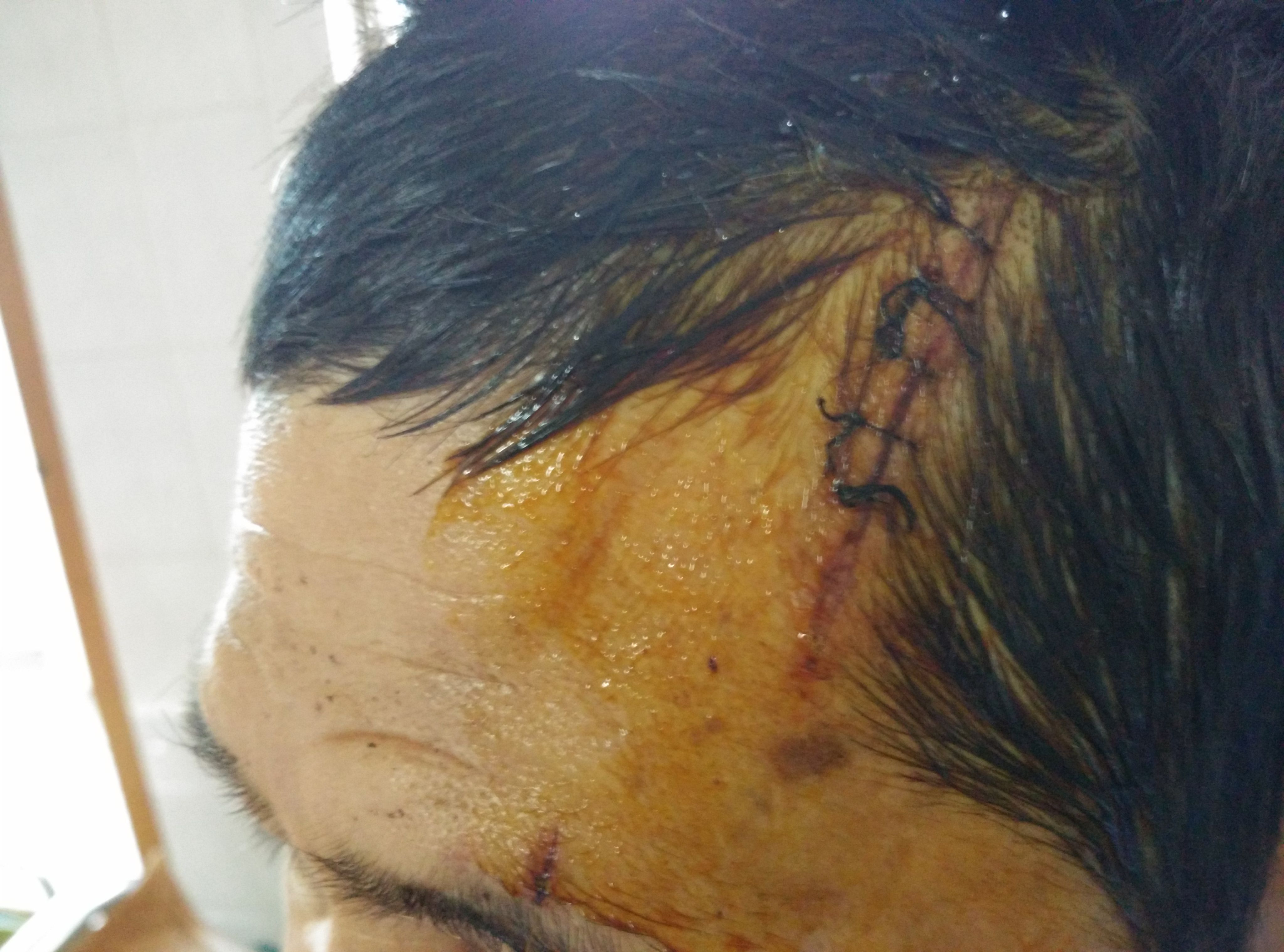 楼上太吵女子持刀划伤邻居 需要承担哪些法律责任