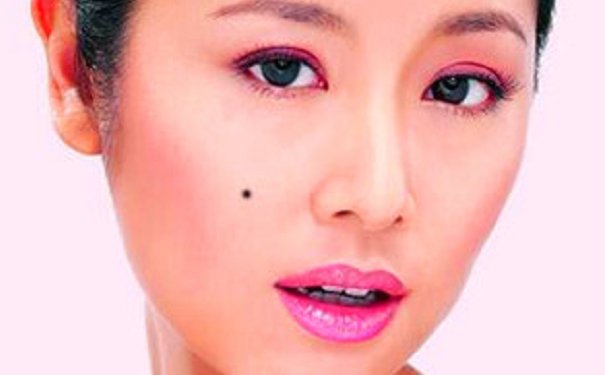 女人10种富贵痣相,你可拥有?