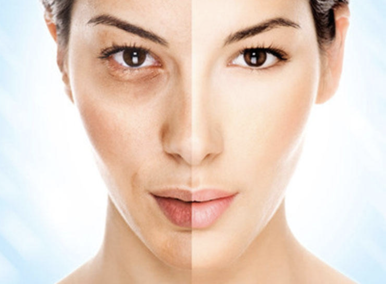 卸妆不干净,等于"毁容",真正懂护肤的人,尤其注意这3点!