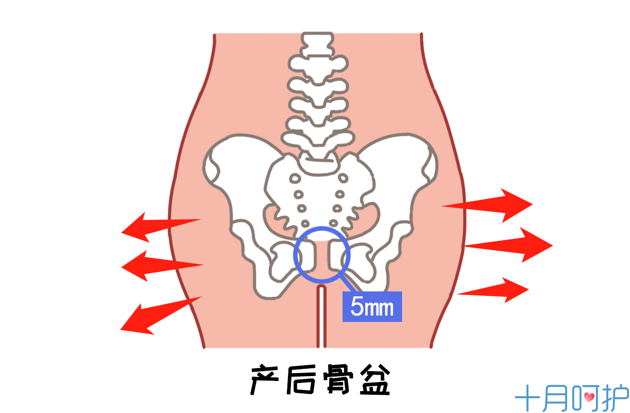 分娩后出现这种情况警惕耻骨联合分离症,千万别马虎大意