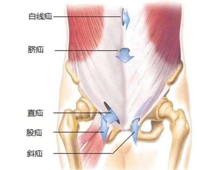 腹股沟区解剖结构3d图图片