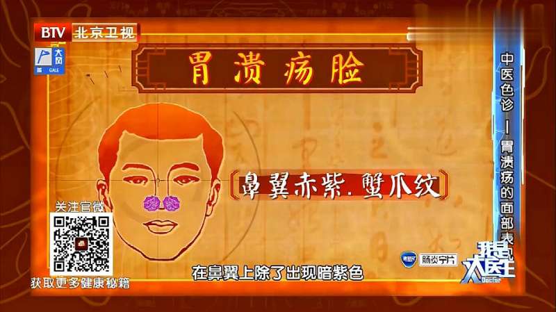 鼻翼两侧出现蟹爪纹 或者暗紫色 可能预测着胃溃疡 生活 健康养生 好看视频
