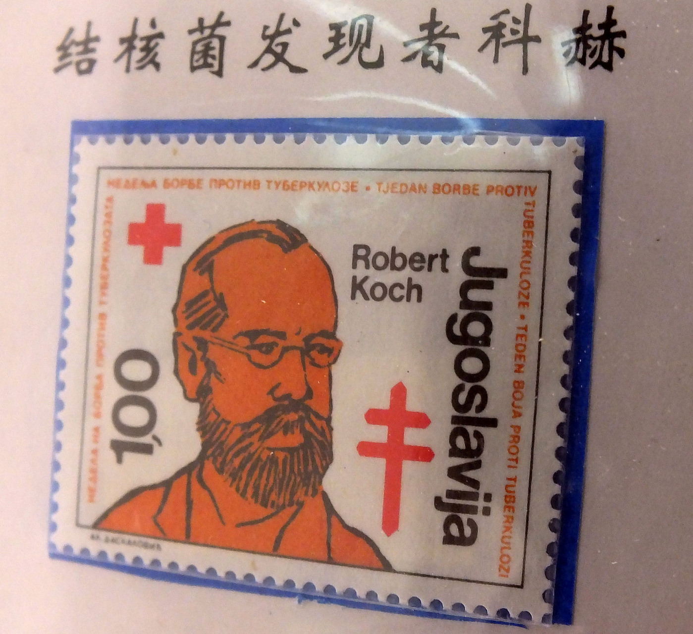 原发型肺结核(Ⅰ型) 儿童多见,是结核菌首次感染肺部的病症.