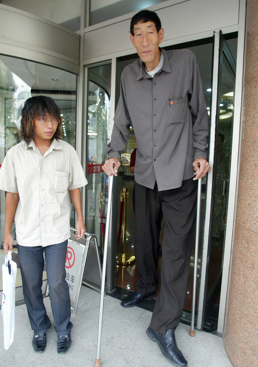 11566 鲍喜顺是中国第一巨人,他的身高达到了2.