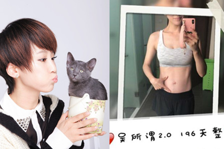 谢楠孕肚呈现出一片紫色,直言称是"静脉曲张"