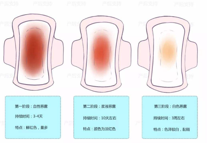 产后恶露排多久最好?若超过这个时间,最好及时就医