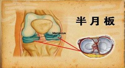 半月板损伤别再浪费钱吃药了,用这个方法就能痊愈,赶快试试!