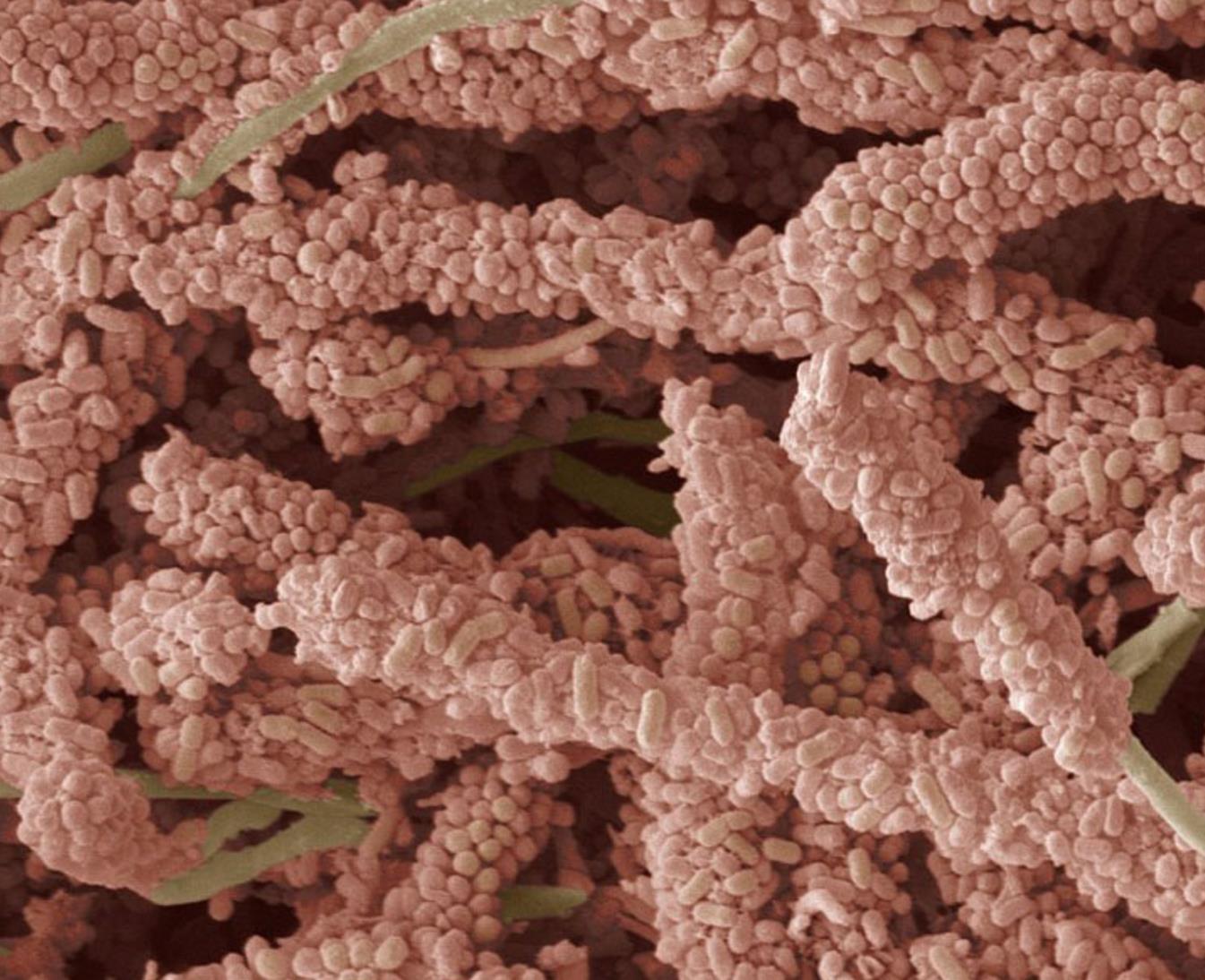 你的牙齿到底有多脏?看完你就知道,把牙齿上的细菌放大1000倍!