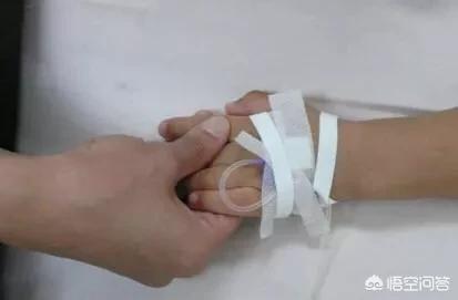 如果像电影里面一样直接扯开手上吊瓶的针头会怎样?