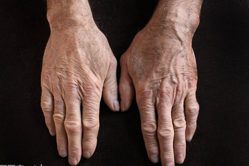 心理题:下面哪个老人的手最沧桑?测你是否天生的劳碌命