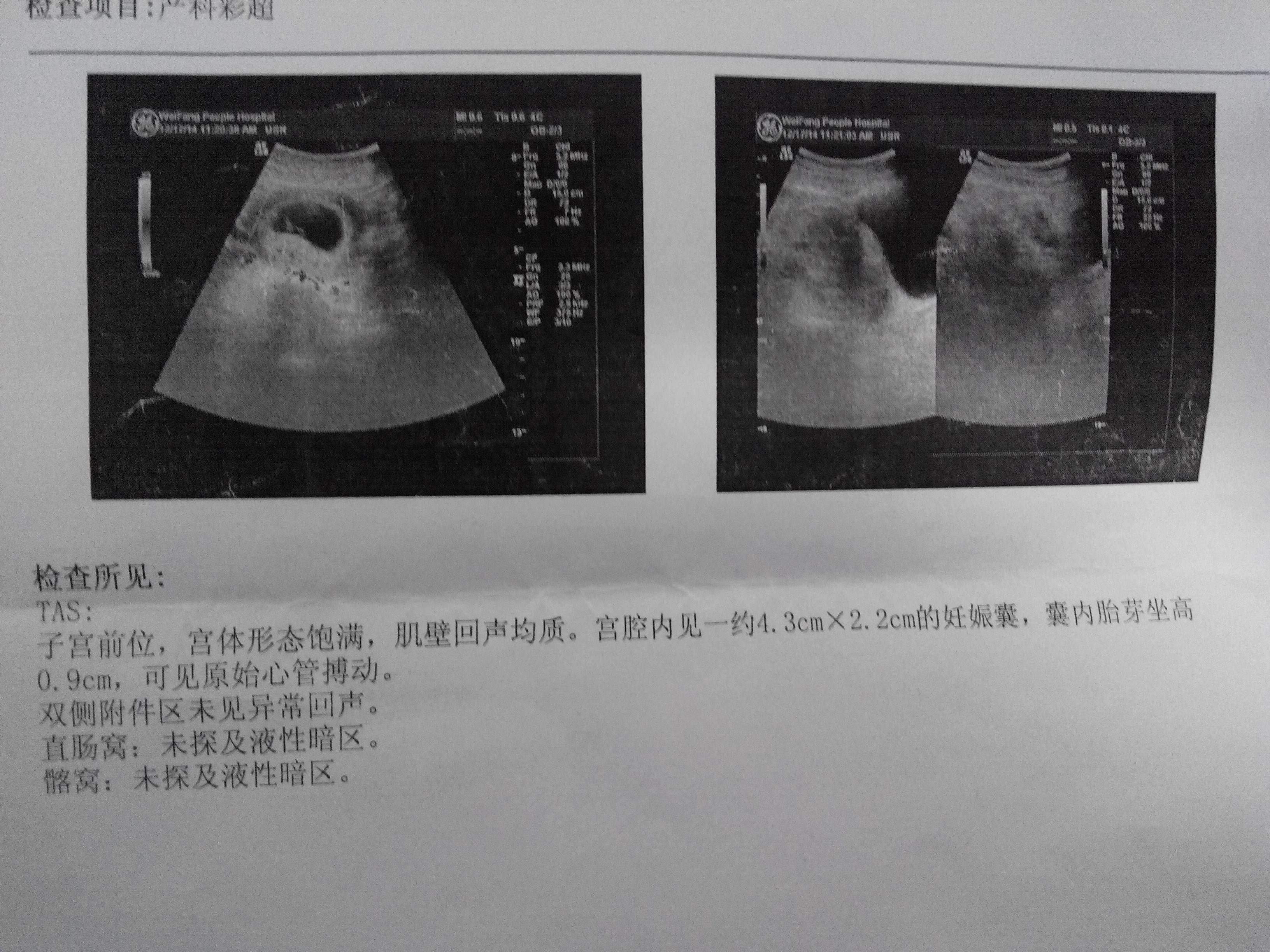 产检单子图片一个月图片