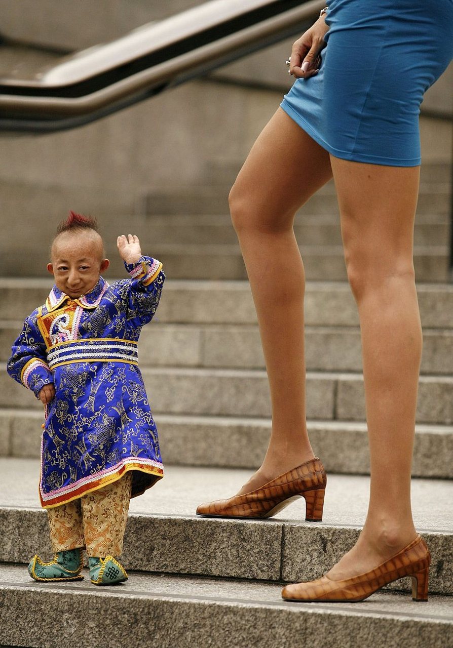 "1988年,"中国第一矮人"在内蒙古出生,接生的产婆断定他活不了.