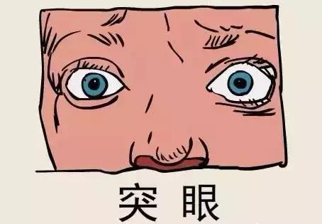 老中医讲解甲亢治好了,突眼会好吗?