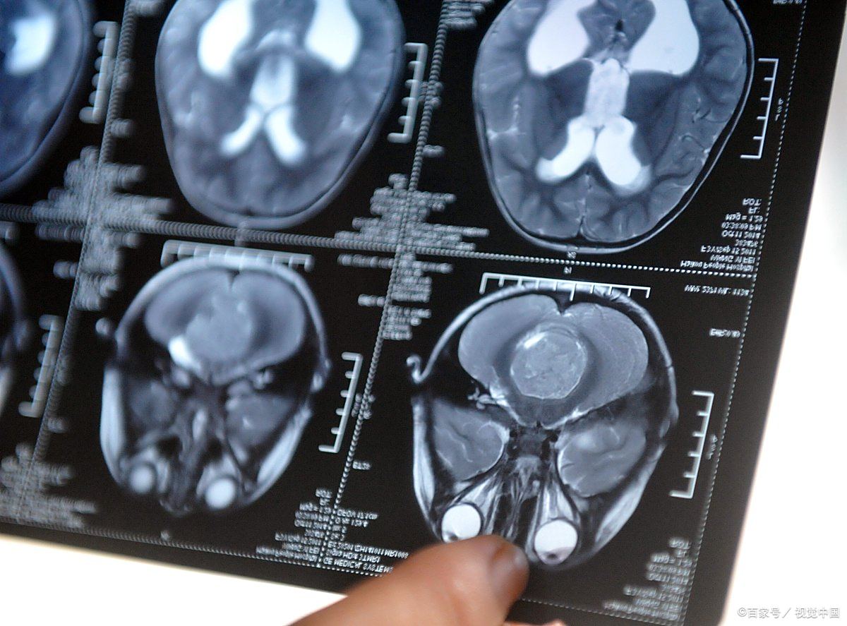 307医院挂号CT加急-307医院pet_ct中心 