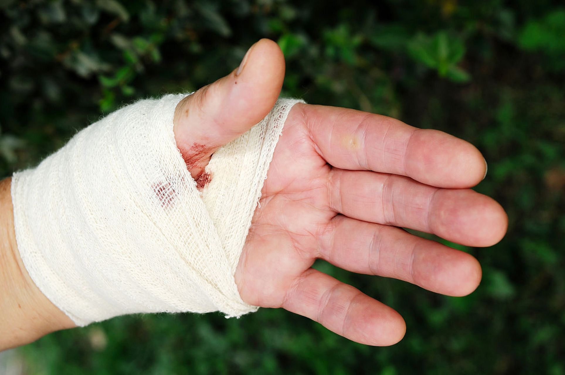 首先,我们要知道,腱鞘炎不是一下子就会找上门的,它通常是因为长期