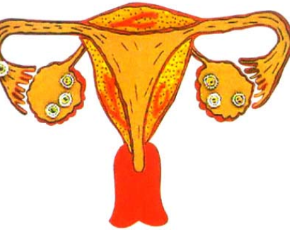 女人这里越"黑",说明子宫毒素就越多,再不排毒会更严重