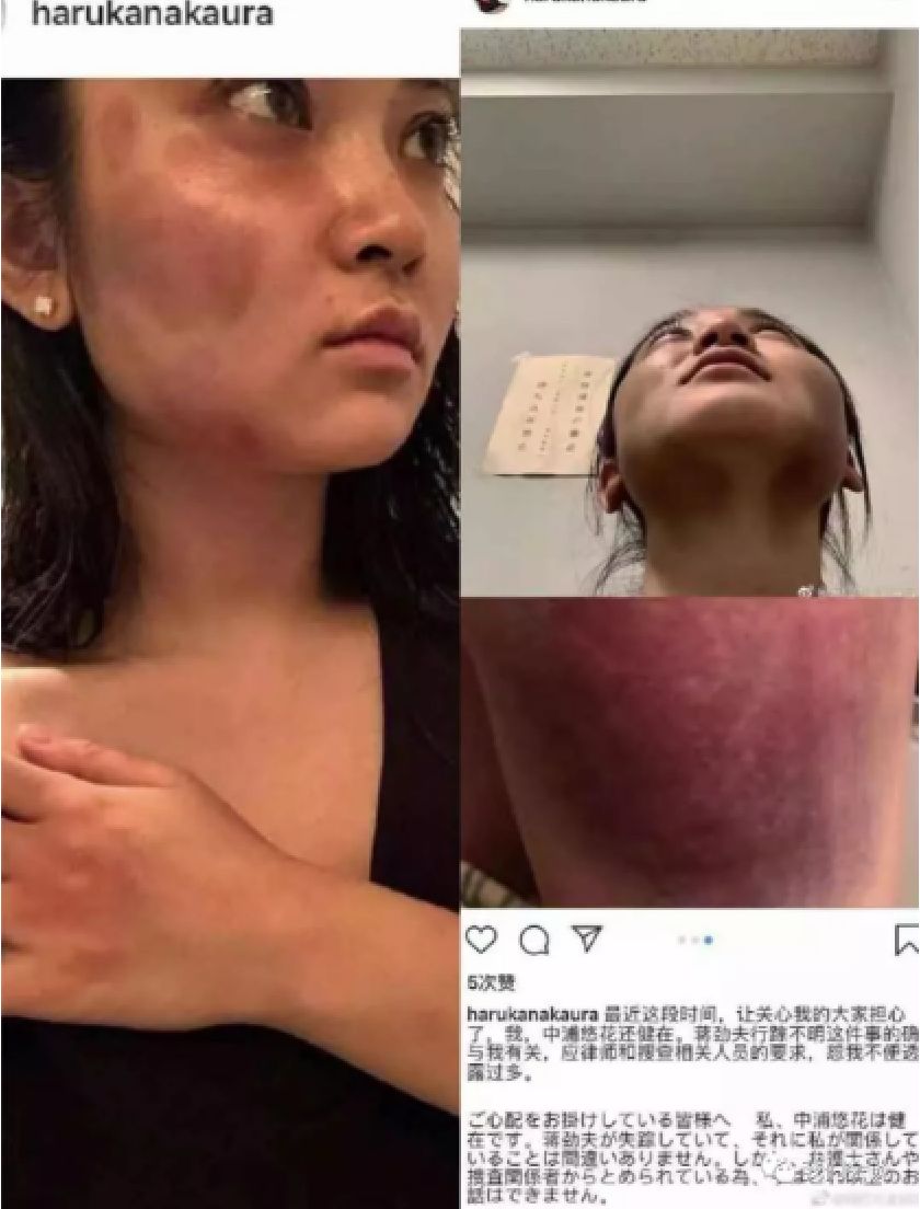 几天前,明星蒋劲夫家暴事件上了热搜, 让家庭暴力再次成为人们关注的