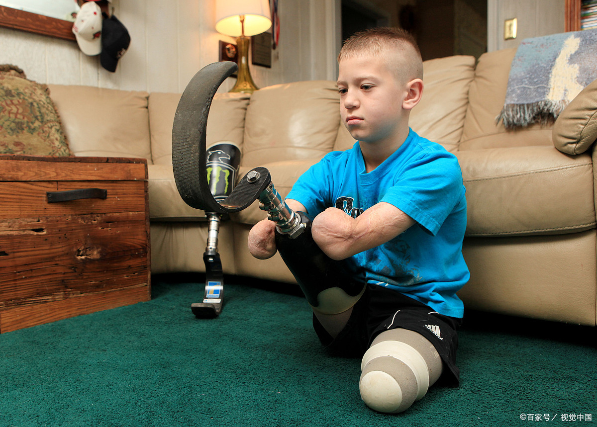 没有四肢的小孩不是重点,假肢以及他开朗乐观的态度才是重点