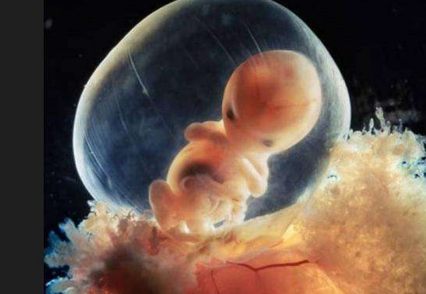 孕9周胎儿真实图图片