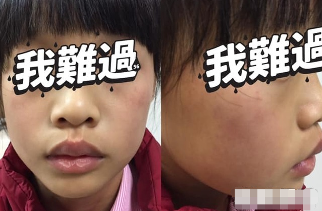 9岁童考试63分挨罚,自己扇脸200下红肿,老师:不能像打蚊子一样